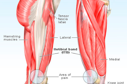 ITB syndrome treatment offered by Vancouver Sports Therapy